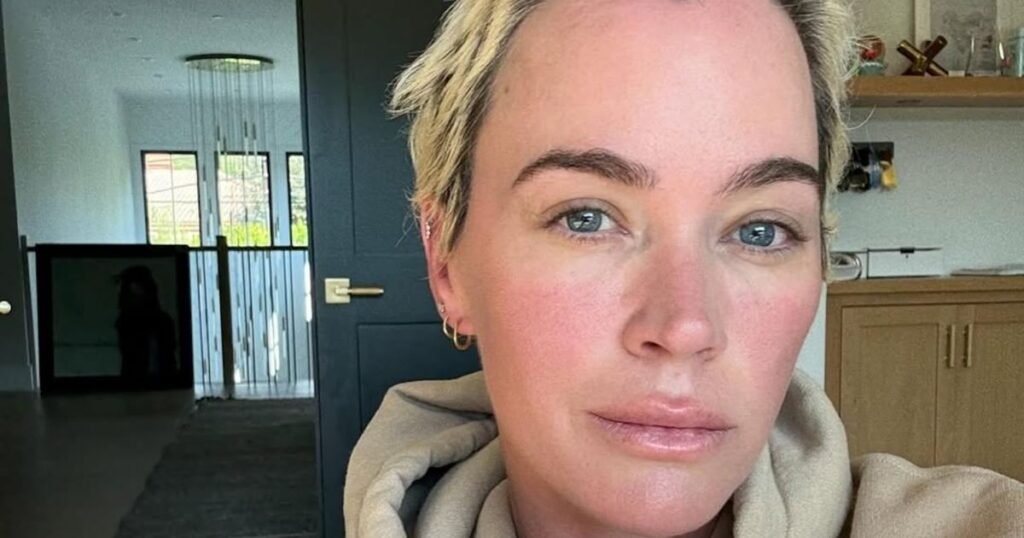 Teddi Mellencamp Shows Hair Growth Progress With Cancer Battle Update Teddi Mellencamp Shows Hair Growth Progress With Cancer Battle Update