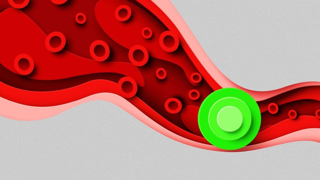 Blood test can detect more than 50 kinds of cancer, new study suggests Blood test can detect more than 50 kinds of cancer, new study suggests