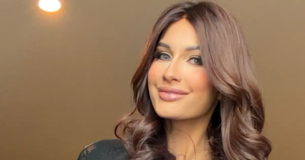 Miss USA Hopeful With Alopecia Ditches Wig, Walks Runway Without Hair