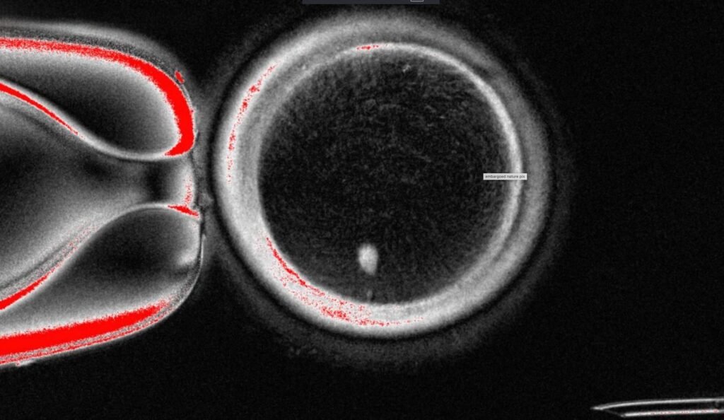 Researchers turn human skin cells into eggs -- but not yet usable ones