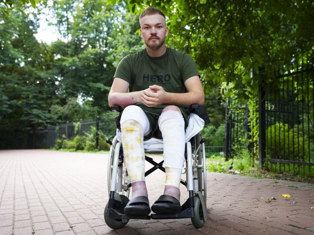 'Nothing's changing': Calgary man recovering in Ukraine sees no end to war