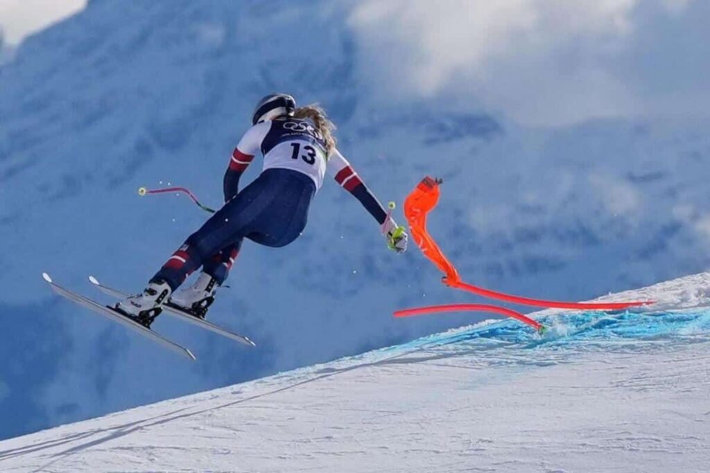Vonn could have lost leg in Olympic accident