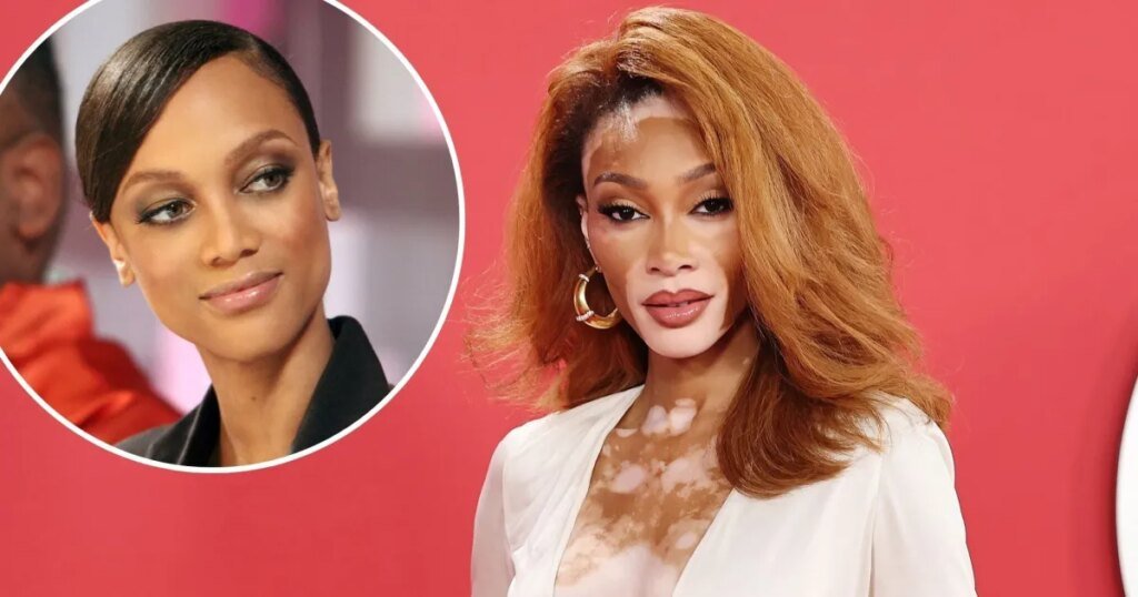 What Has Winnie Harlow Said About ANTM? Supermodel Was Missing From Doc