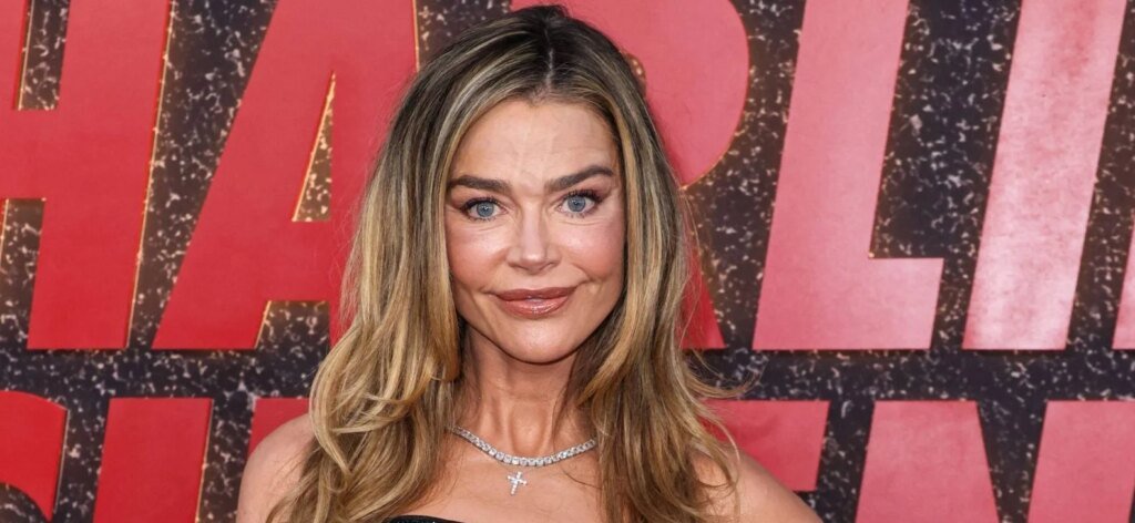 Denise Richards' Facelift Result Has Fans Saying She 'Deserved' It