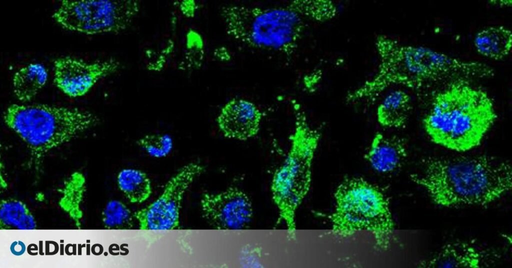 España inicia los ensayos clínicos de un fármaco contra la ELA