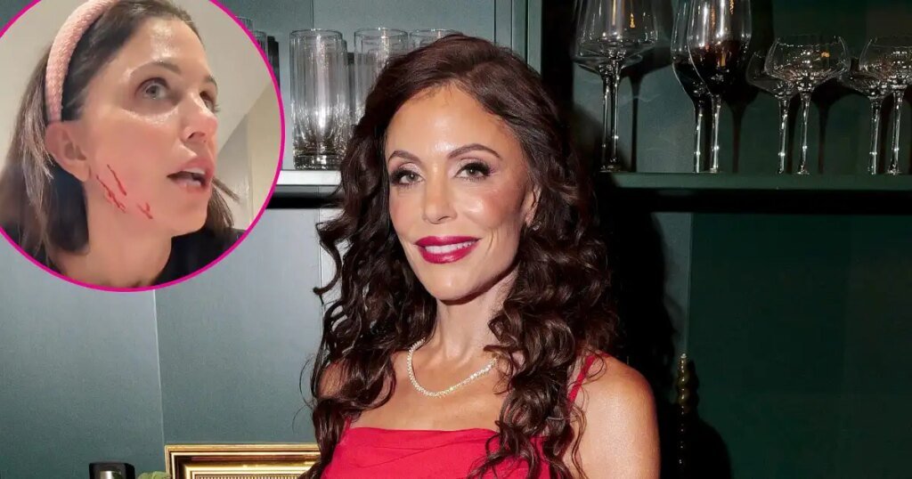 What Happened to Bethenny Frankel’s Face? Drama Explained