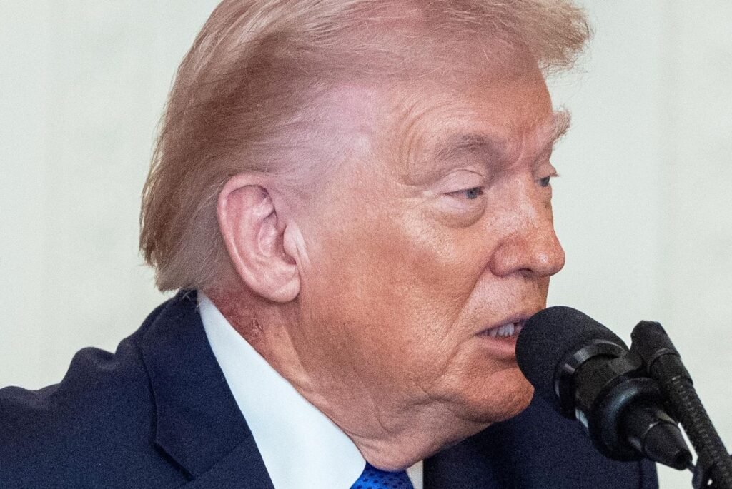 White House says Trump's red neck rash was caused by prescription skin cream