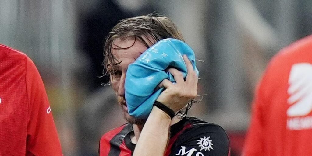 Modric set for surgery on facial injury
