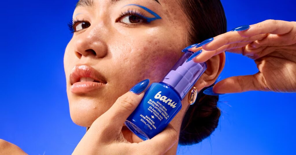 Acne’s Big Breakout Moment