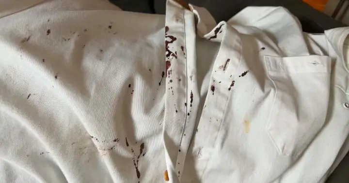 Assault charges laid after chef, bartender injured during Calgary bar fight – Calgary Assault charges laid after chef, bartender injured during Calgary bar fight - Calgary