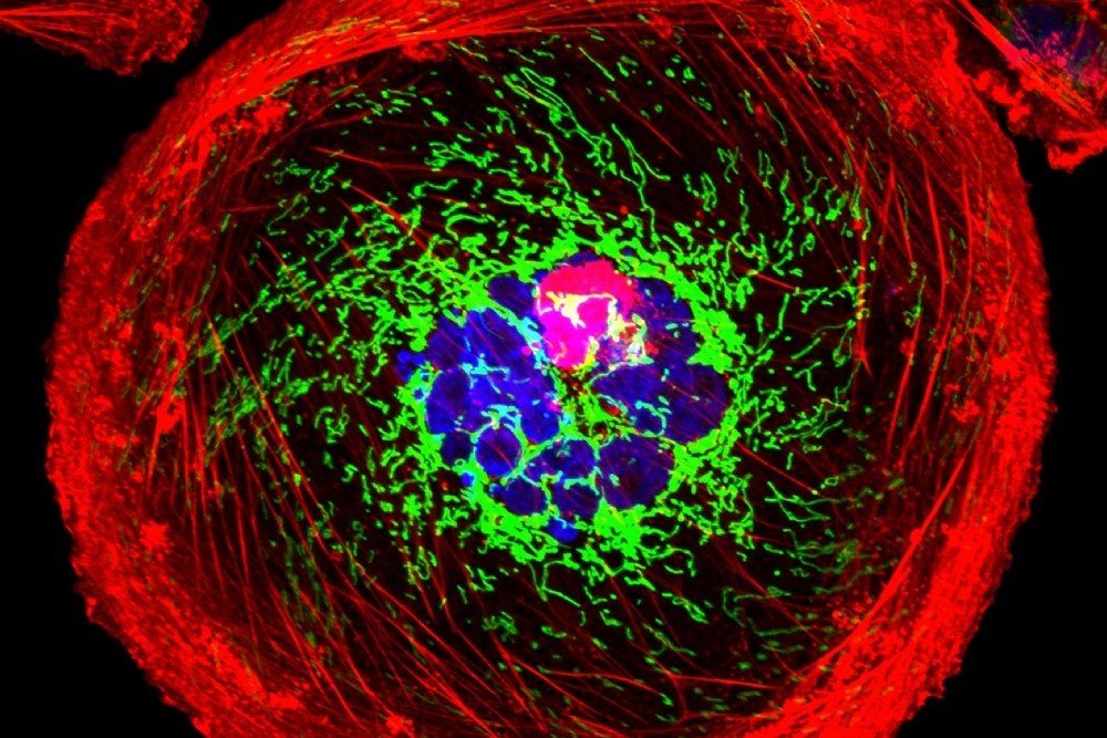 AstraZeneca, Daiichi Drug Approved as New First-Line Therapy for Tough Type of Breast Cancer AstraZeneca, Daiichi Drug Approved as New First-Line Therapy for Tough Type of Breast Cancer