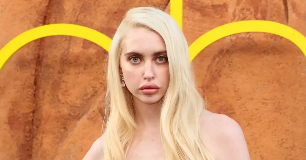 Euphoria’s Chloe Cherry Opens Up About Getting Lip Filler