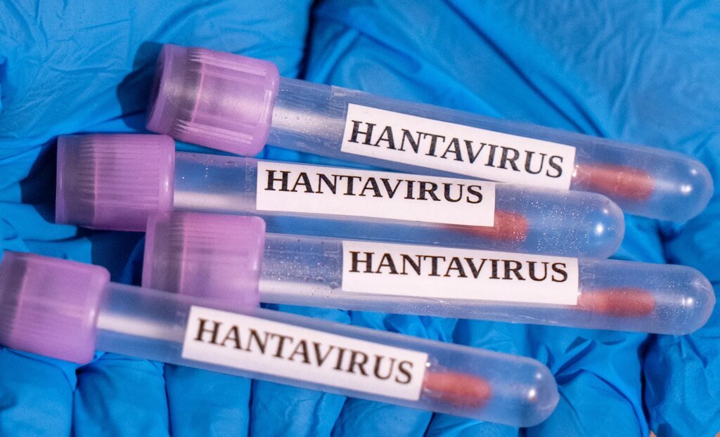 Hantavirus Cruise Ship Evacuations Begin After Deadly Outbreak