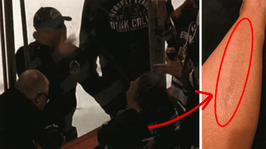 Hershey Entertainment niega responsabilidad por las lesiones de una mujer en el juego de los Hershey Bears – Celebrity Land