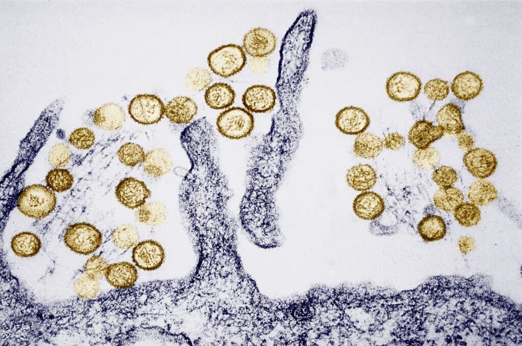 Initial genetic analysis of the ‘MV Hondius’ hantavirus outbreak confirms it belongs to the Andes strain and rules out mutations | Health