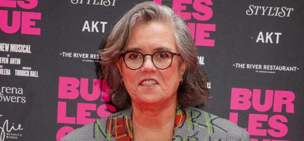 Rosie O’Donnell Faces Mockery After Unveiling Facelift Results Rosie O'Donnell Faces Mockery After Unveiling Facelift Results