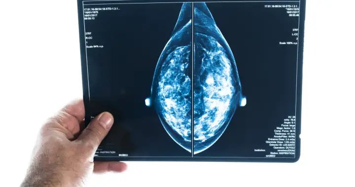 These are the Canadian regions with the highest rates of breast cancer – National These are the Canadian regions with the highest rates of breast cancer - National