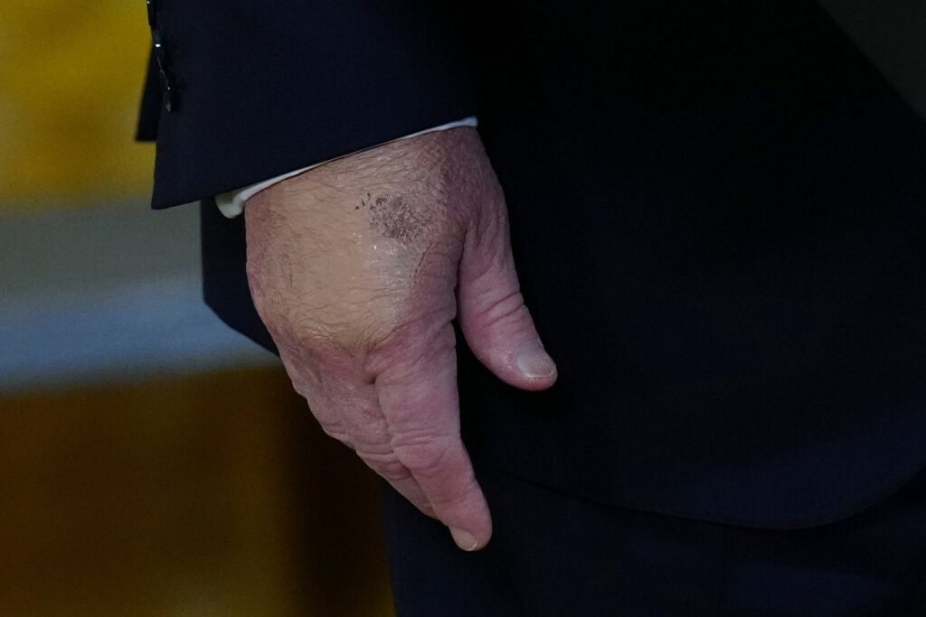Trump is getting another medical checkup at the end of May, the White House says