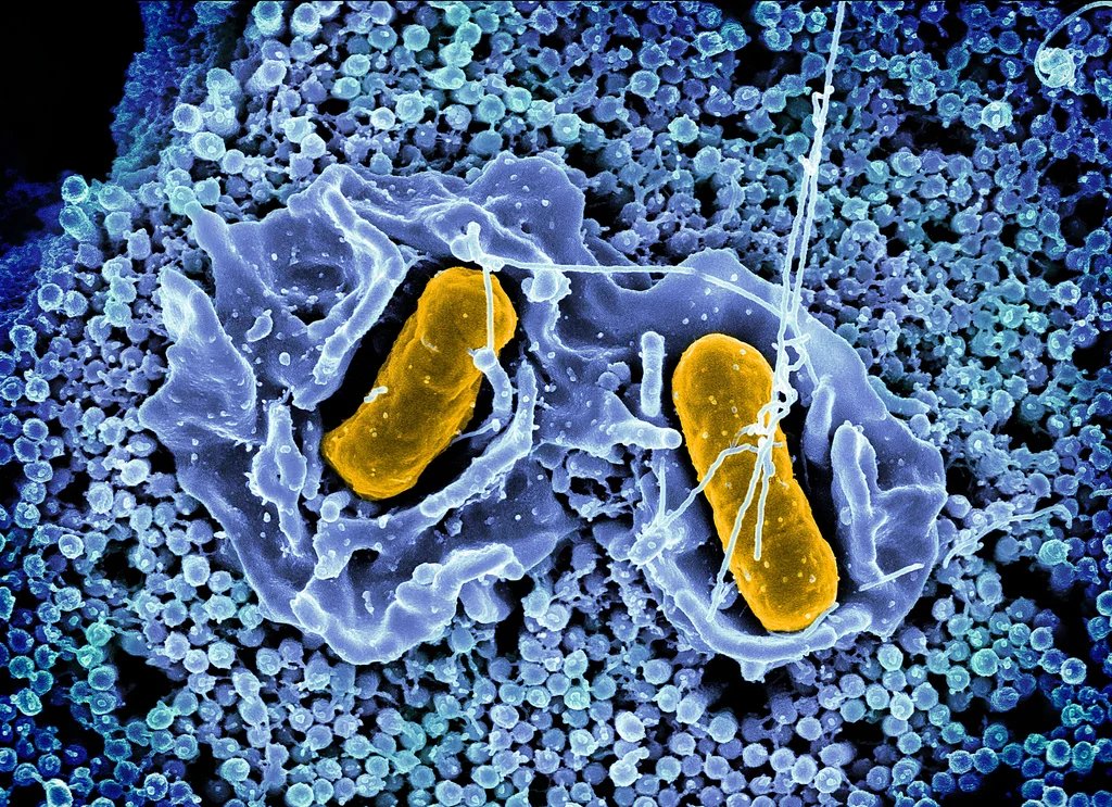 Why are there so many Salmonella outbreaks? 4 reasons for the nonstop food recalls, sicknesses, and safety warnings this year Why are there so many Salmonella outbreaks? 4 reasons for the nonstop food recalls, sicknesses, and safety warnings this year