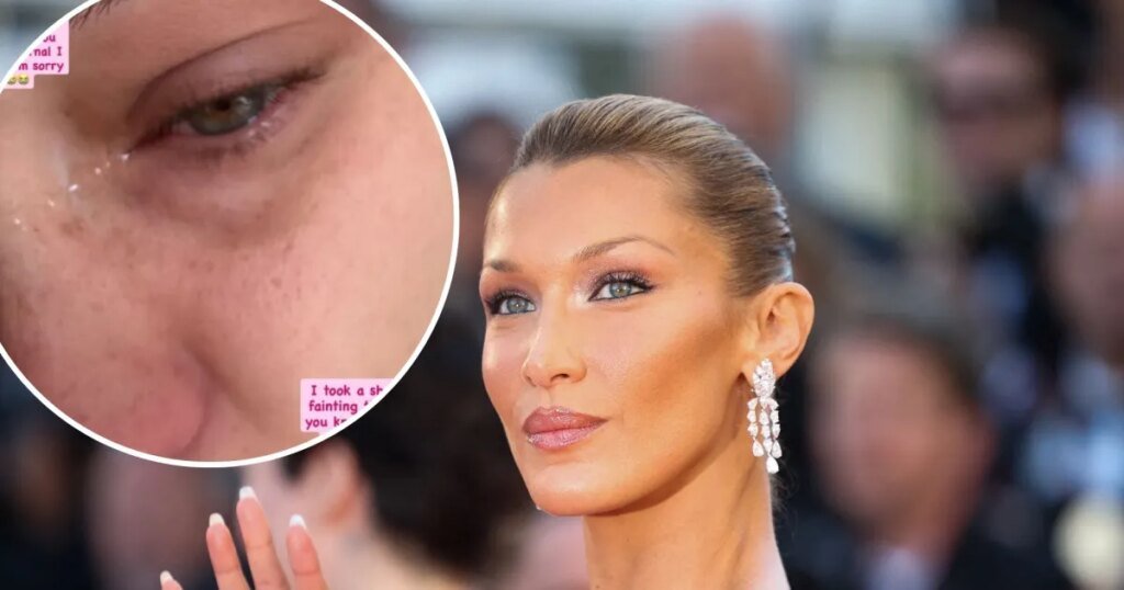 Bella Hadid Tears Up, Details Chronic Illness From Lyme Disease
