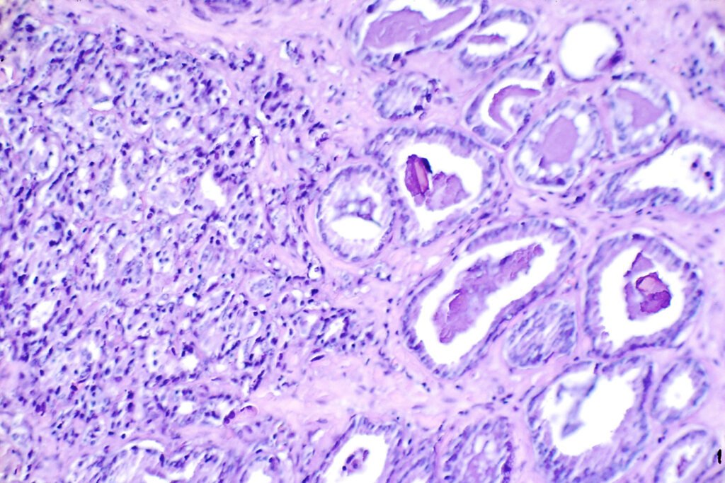 New Cancer Biotech Unveils $27M for Dual-Targeting Prostate Cancer Drug