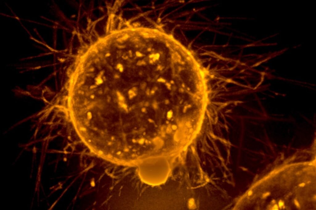 Startup Secures $86M to Take On One of the Challenges for ADCs in Breast Cancer