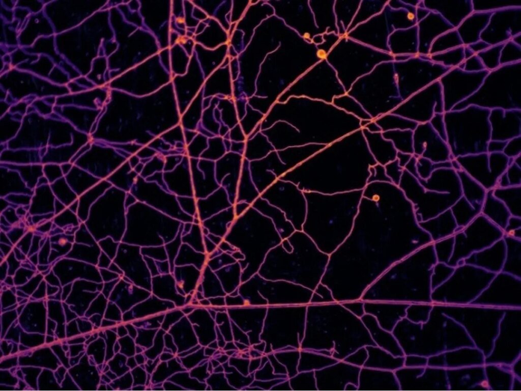 Study maps quadrillion-mile fungus web lurking in topsoil Study maps quadrillion-mile fungus web lurking in topsoil