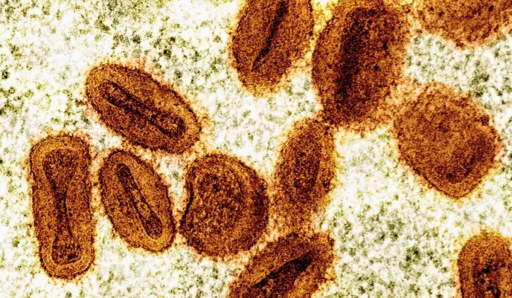 Two foreign nationals working at NIH laboratory charged with smuggling mpox virus into the U.S.