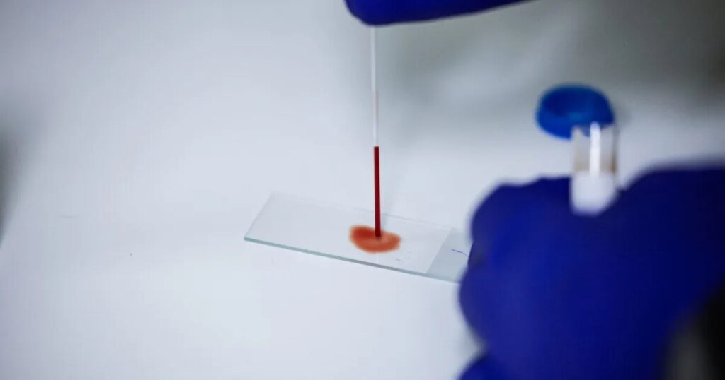 What Is the Anti-Aging Bacteria Found in Human Blood? What Is the Anti-Aging Bacteria Found in Human Blood?
