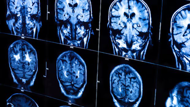 Women with traumatic brain injury 26 per cent less likely to receive trauma care than men, Ontario study finds Women with traumatic brain injury 26 per cent less likely to receive trauma care than men, Ontario study finds