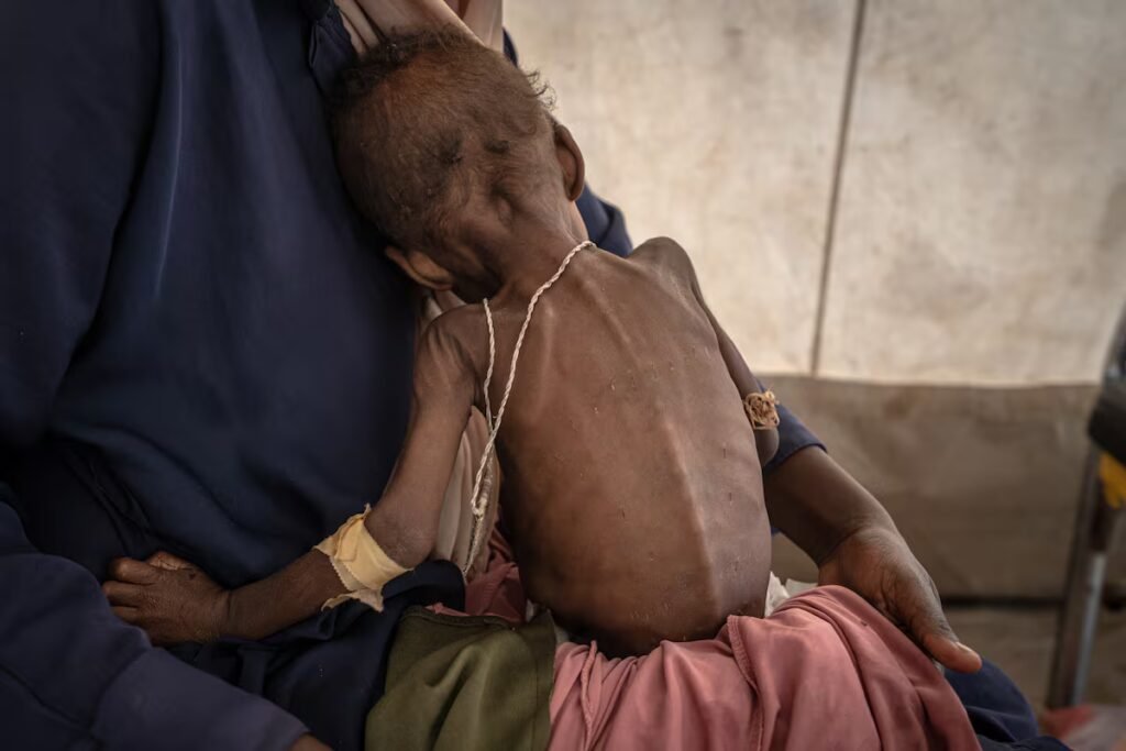 Africa becomes the global epicenter of hunger for the first time | International Africa becomes the global epicenter of hunger for the first time | International