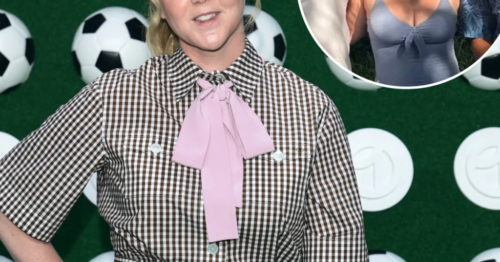 Amy Schumer Poses In Stunning One-Piece Amid Weight Loss