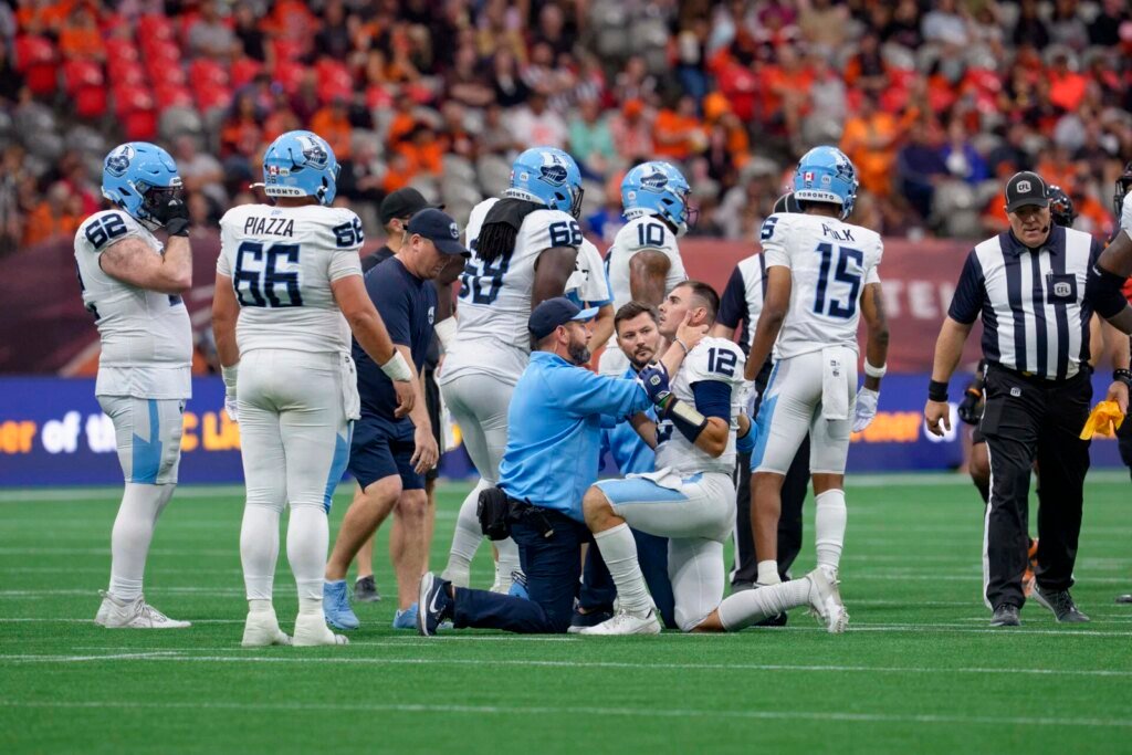 Chad Kelly not expected to miss time for Toronto Argonauts: report