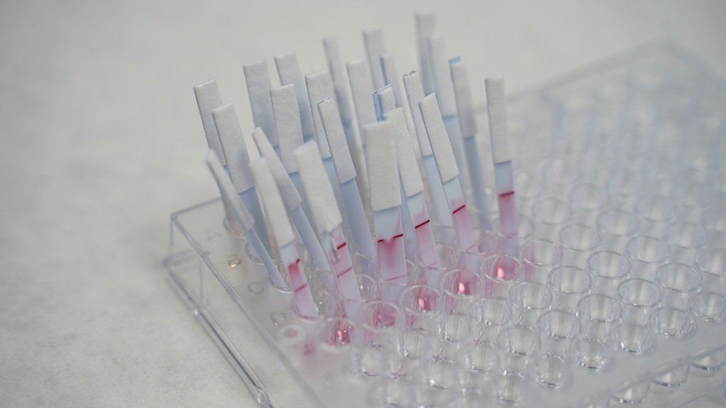 Detección rápida de Salmonella y Listeria en alimentos mediante biosensores avanzados Detección rápida de Salmonella y Listeria en alimentos mediante biosensores avanzados
