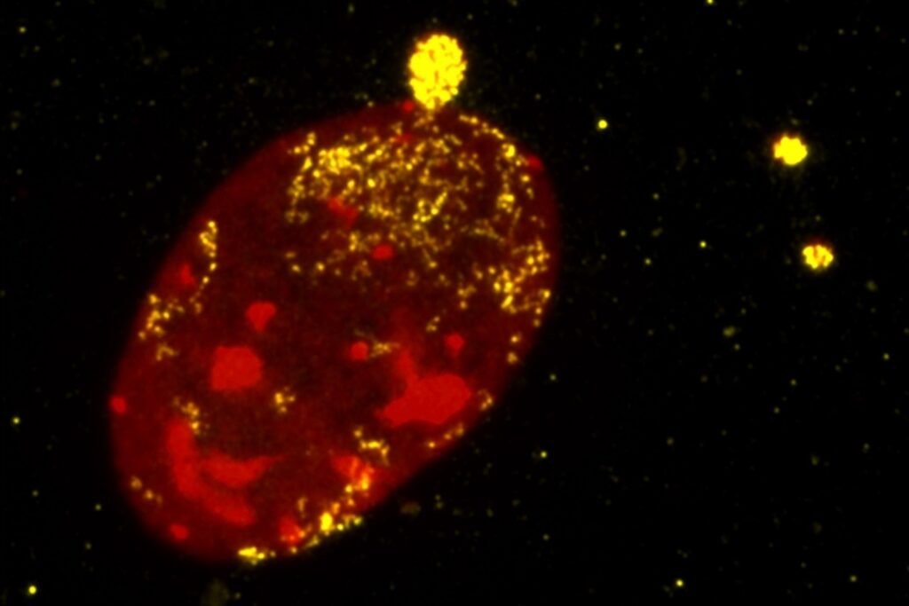 Expecting Massive Test Growth in Cancer & More, Tempus AI Strikes $1.5B Deal to Buy Personalis Expecting Massive Test Growth in Cancer & More, Tempus AI Strikes $1.5B Deal to Buy Personalis