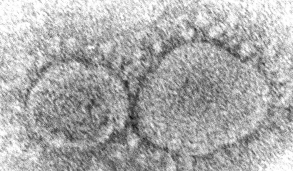 HHS adopts limit to ‘dangerous’ virus research a year after Trump order reining in federal support