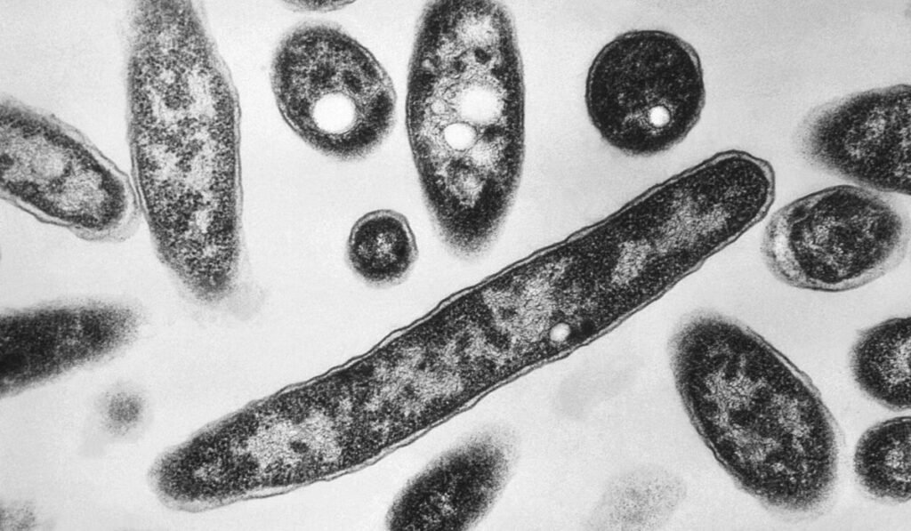 New diagnoses slow in NYC Legionnaires’ disease outbreak; source still unclear New diagnoses slow in NYC Legionnaires’ disease outbreak; source still unclear