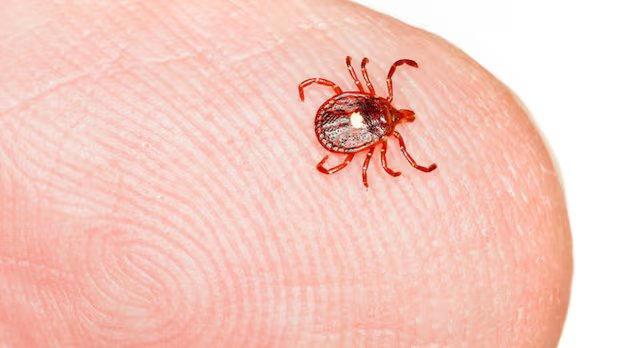 Rare tick-bite allergy leaves Nova Scotia woman unable to eat meat or dairy Rare tick-bite allergy leaves Nova Scotia woman unable to eat meat or dairy