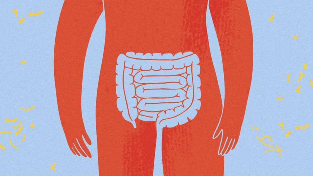 Why are healthy young adults getting colon cancer? Researchers may finally have a lead Why are healthy young adults getting colon cancer? Researchers may finally have a lead