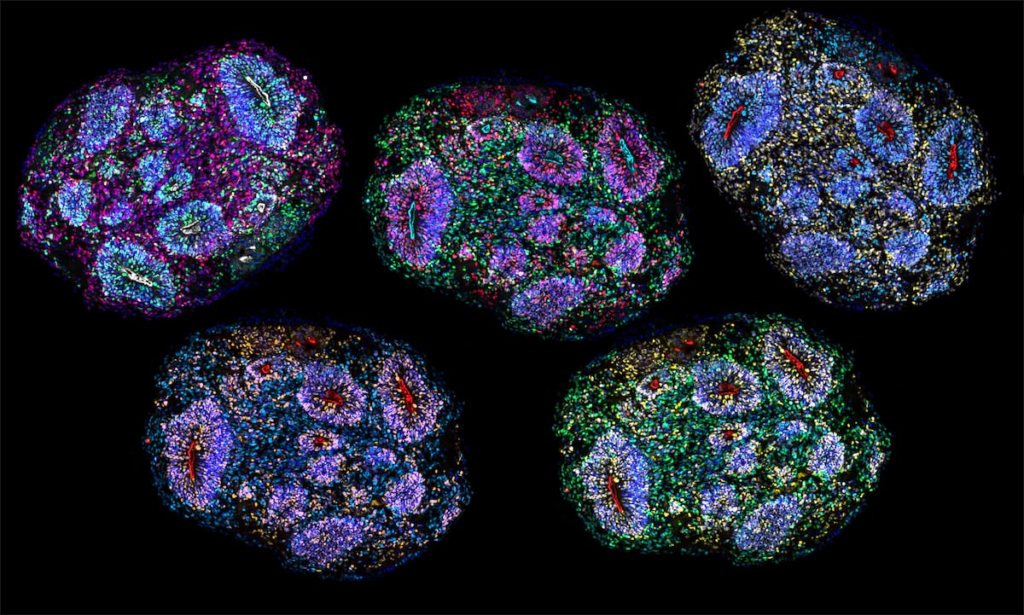 Breakthrough in neuromedicine as human mini-brains are kept alive for years | Science