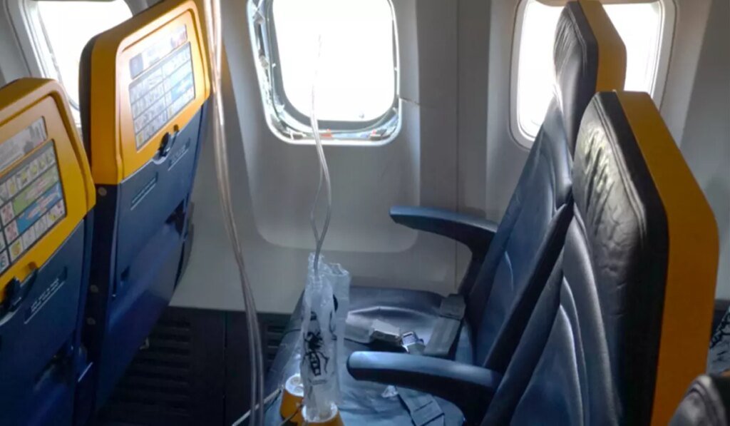 Broken engine parts shattered the Ryanair plane window that a passenger’s head got sucked into: NTSB