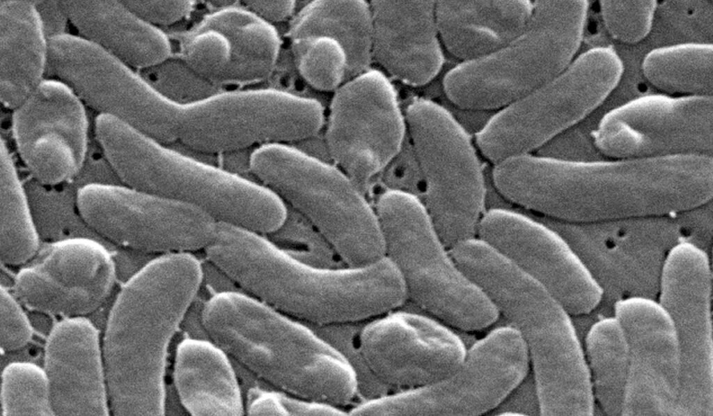 Flesh-eating bacteria kills 5 in Louisiana as cases outpace 10-year average Flesh-eating bacteria kills 5 in Louisiana as cases outpace 10-year average