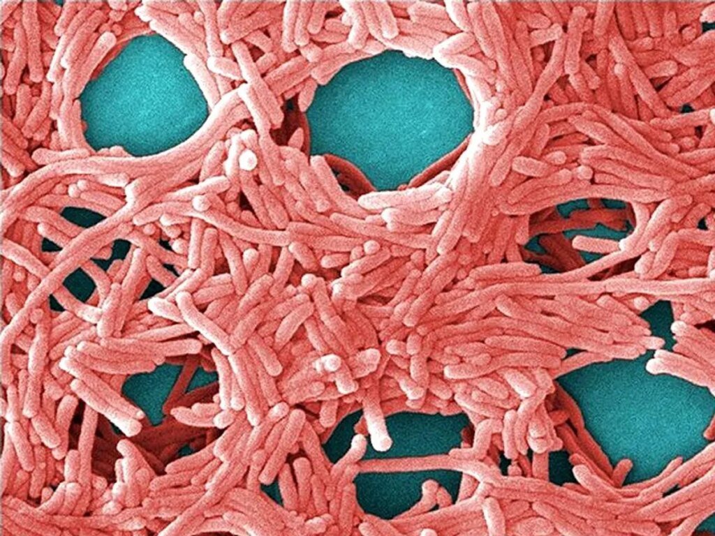 Legionnaires' disease causes and symptoms as health officials investigate Toronto outbreak Legionnaires' disease causes and symptoms as health officials investigate Toronto outbreak