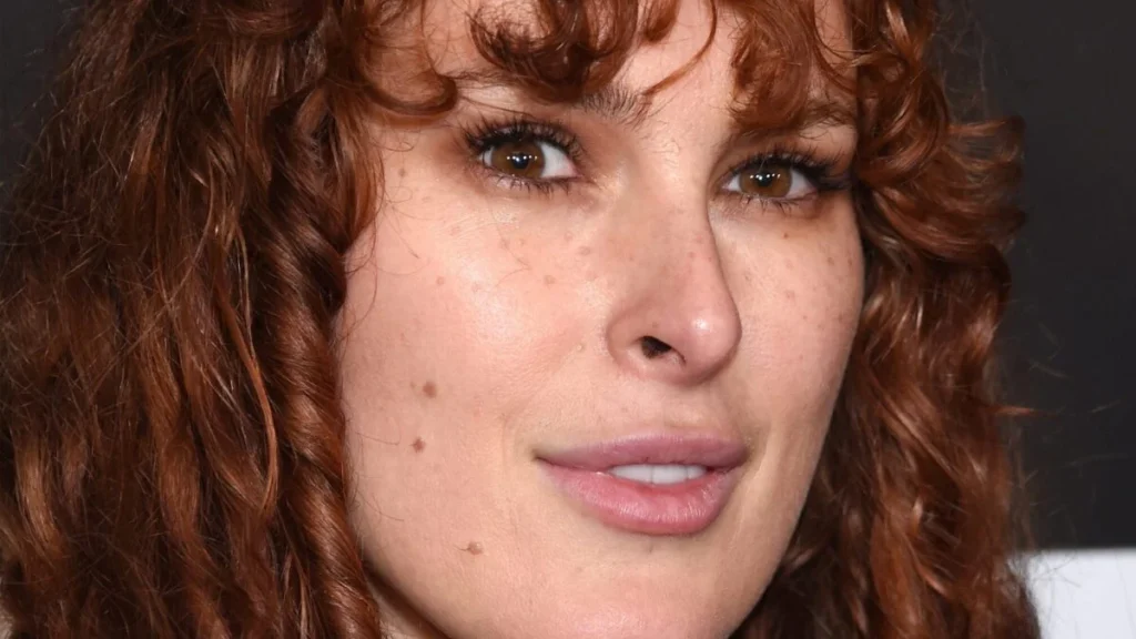 Rumer Willis' Health Fears Deepen Amid Bruce's Dementia
