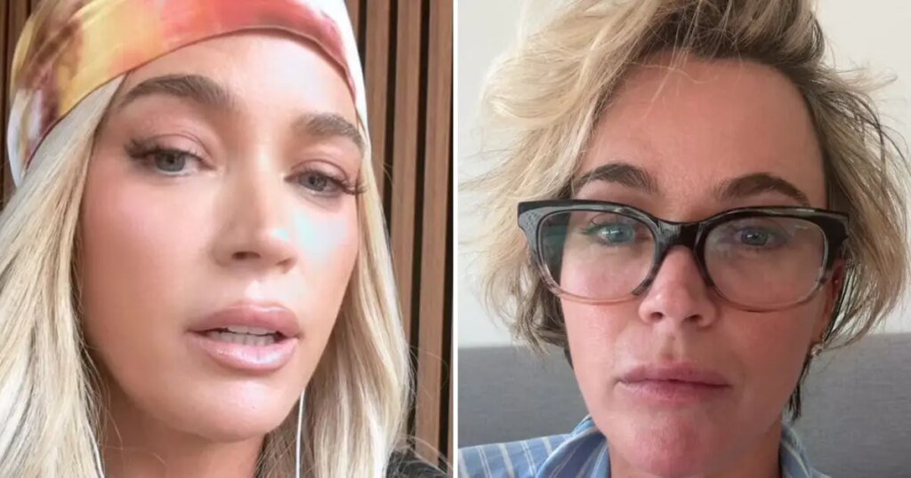 Teddi Mellencamp Takes Off Wig, Shows Real Hair Amid Cancer